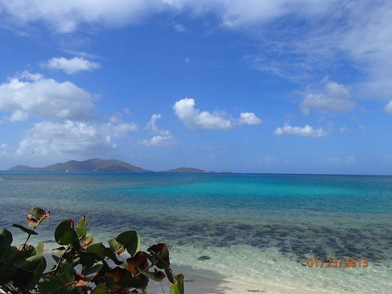 Radiesse: Non-Surgical Facelift