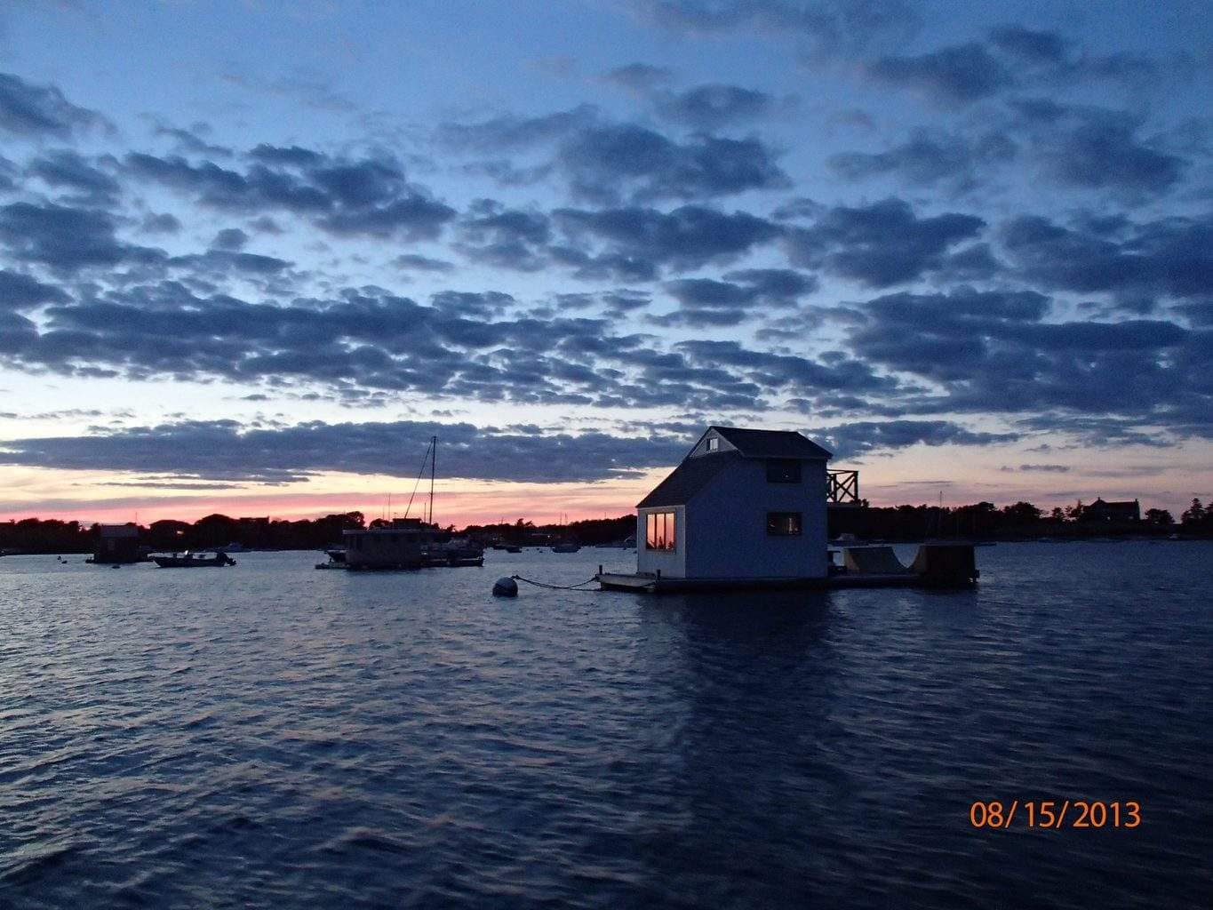 Filler Radiesse Dr Kimberley O’Sullivan Cosmetic Surgery Video Testimonial